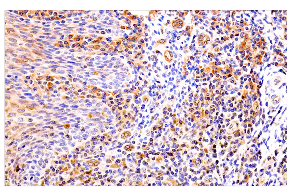 Immunohistochemistry Image 14: HLA-E (MEM-E/02) Mouse Monoclonal Antibody