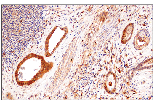 Immunohistochemistry Image 4: Enolase-2 (E2H9X) Rabbit Monoclonal Antibody