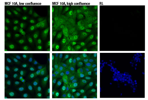 YAP (D8H1X) XP® Rabbit mAb (BSA and Azide Free) | Cell