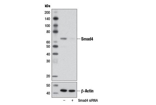 Western Blotting Image 2: Smad4 Antibody