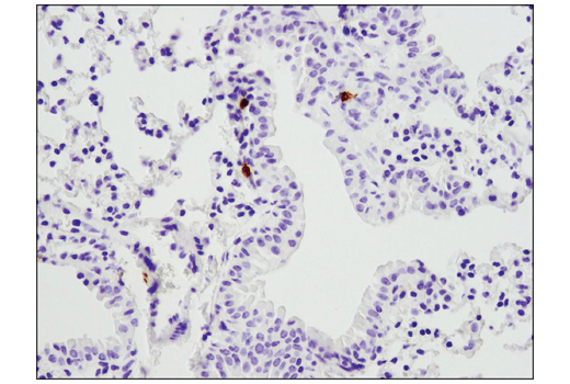 Immunohistochemistry Image 4: PD-1 (Intracellular Domain) (D7D5W) Rabbit Monoclonal Antibody