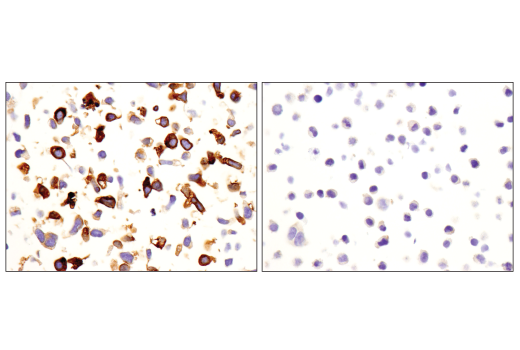 Immunohistochemistry Image 6: CD163 (D6U1J) Rabbit Monoclonal Antibody (BSA and Azide Free)