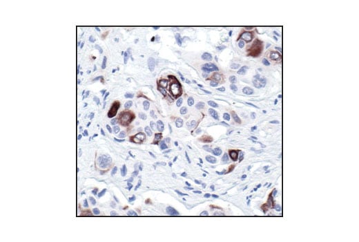 Immunohistochemistry Image 4: Phospho-NF-kappaB p105 (Ser932) (178F3) Rabbit Monoclonal Antibody (BSA and Azide Free)
