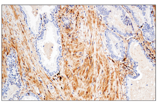 Immunohistochemistry Image 8: Enolase-2 (E2H9X) Rabbit Monoclonal Antibody