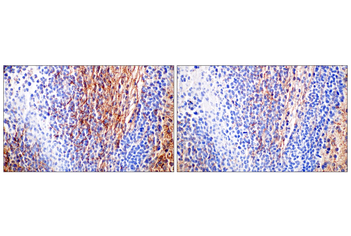 Immunohistochemistry Image 7: Doublecortin (E3S7L) Rabbit Monoclonal Antibody