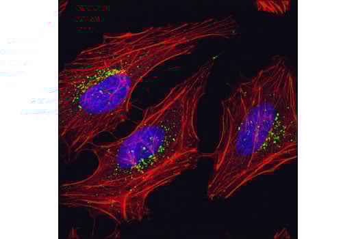 undefined Image 13: mTOR Regulation Antibody Sampler Kit