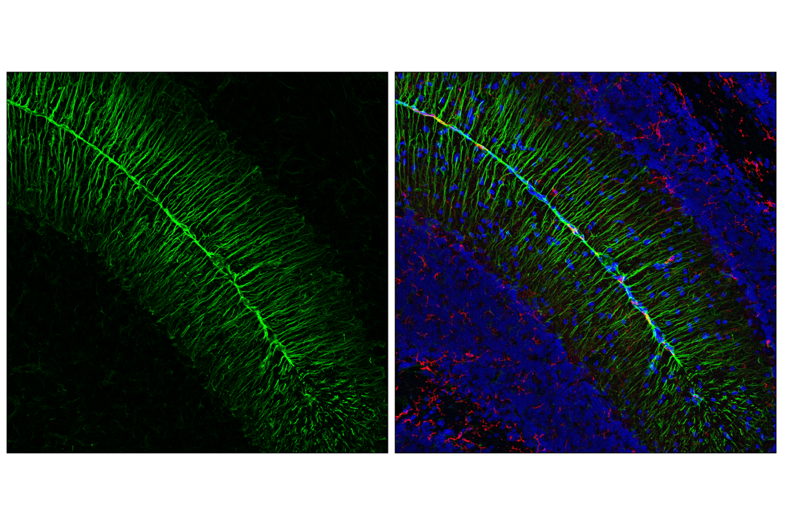 Immunofluorescence Image 2: Vimentin (D21H3) Rabbit Monoclonal Antibody