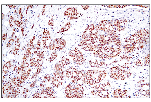 Immunohistochemistry Image 1: RAI17/ZMIZ1 (E2X3X) Rabbit Monoclonal Antibody