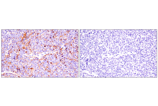 Immunohistochemistry Image 3: CD21/CR2 (2G9) Mouse Monoclonal Antibody