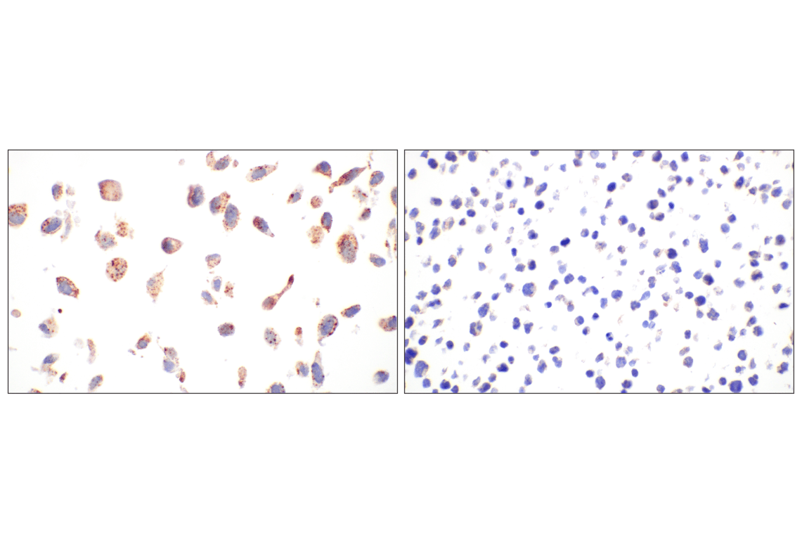 Immunohistochemistry Image 13: EEA1 (E9Q6G) Mouse Monoclonal Antibody