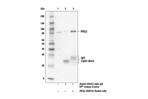 Immunoprecipitation Image 1: PKC beta (D3E7O) Rabbit Monoclonal Antibody