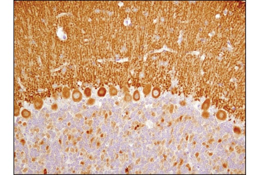 undefined Image 11: Fragile X/FMRP Signaling Pathway Antibody Sampler Kit