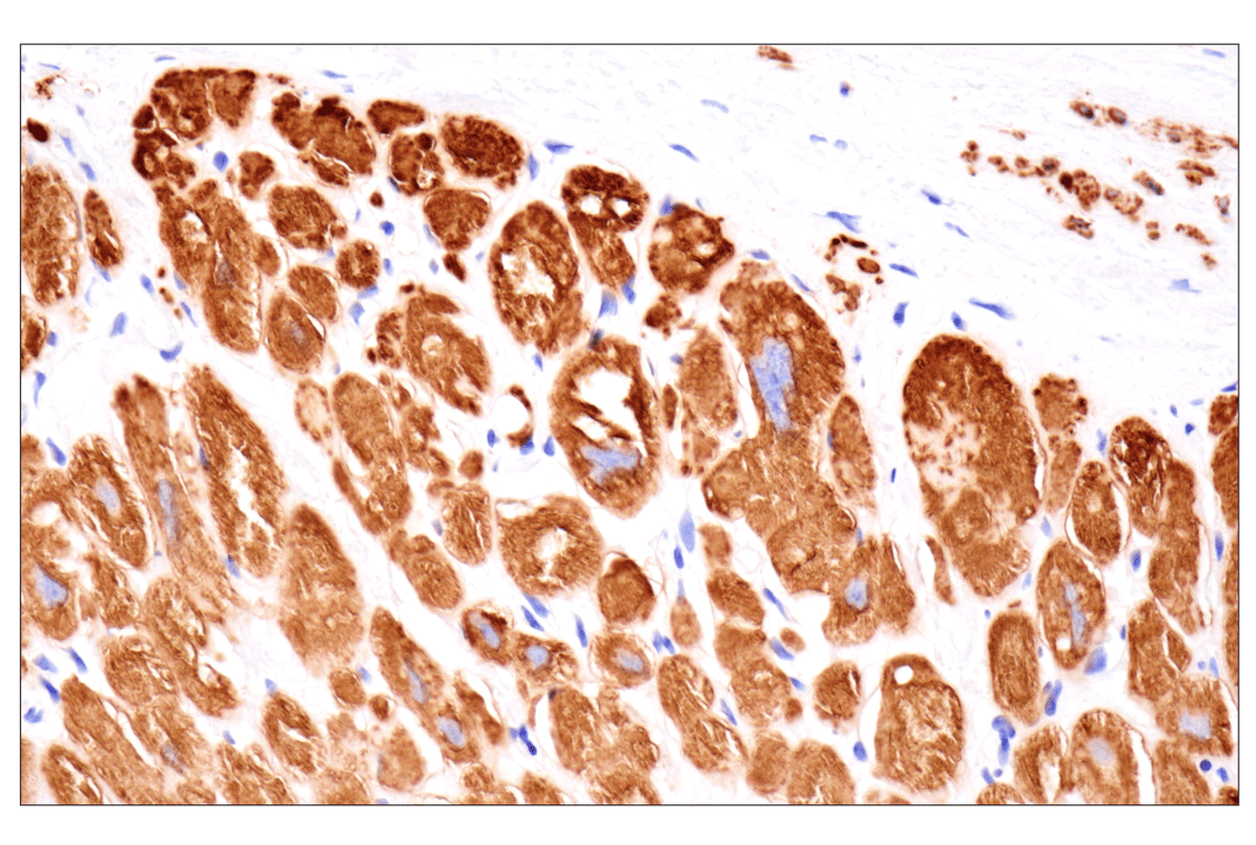 Immunohistochemistry Image 7: Desmin (F5V4I) Rabbit Monoclonal Antibody