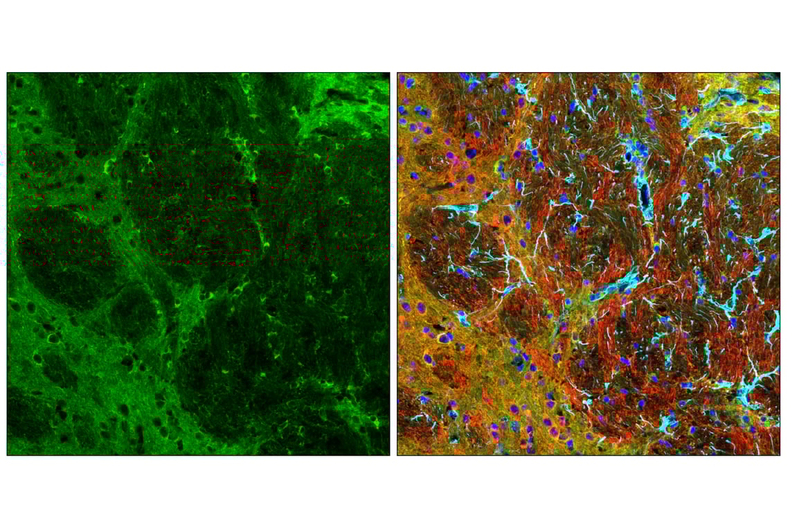 Immunofluorescence Image 1: Phospho-Tau (Thr205) (E8Q5Z) Mouse Monoclonal Antibody (BSA and Azide Free)