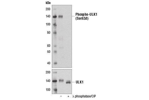 Western Blotting Image 2: Phospho-ULK1 (Ser638) (D8K9O) Rabbit Monoclonal Antibody
