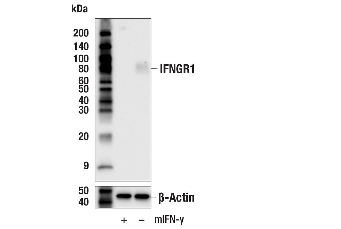 Western Blotting Image 2: IFNGR1 (E3I8B) Rabbit Monoclonal Antibody