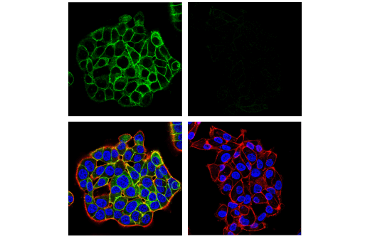 Immunofluorescence Image 1: RhoB (D1J9V) Rabbit Monoclonal Antibody