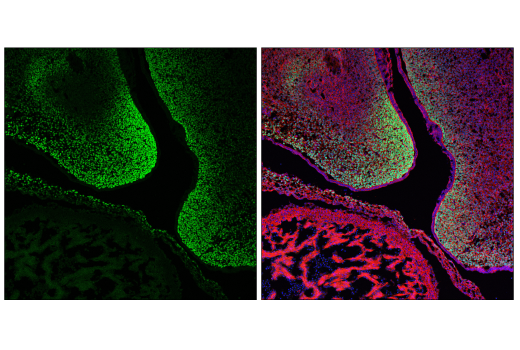 undefined Image 70: Epithelial-Mesenchymal Transition (EMT) IF Antibody Sampler Kit