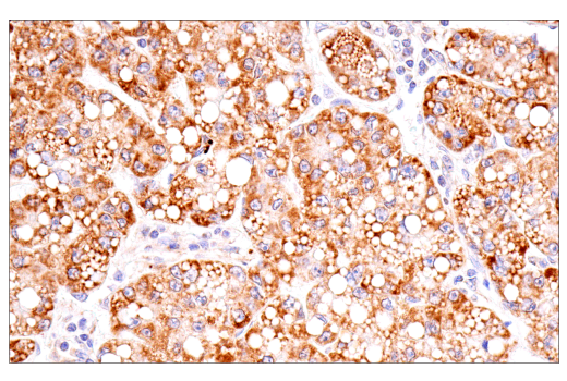 Immunohistochemistry Image 1: Cox2 (D5H5) Rabbit Monoclonal Antibody (BSA and Azide Free)