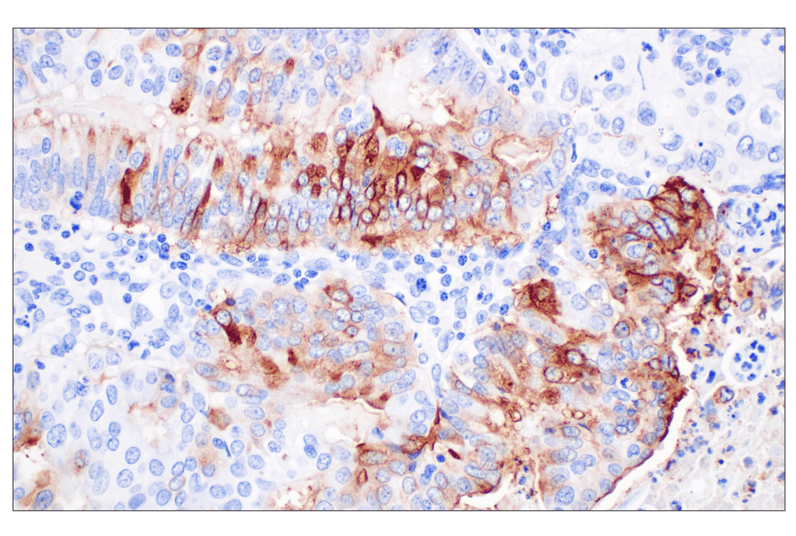 Immunohistochemistry Image 2: ALPP/ALPPL2 (F1L4G) Rabbit Monoclonal Antibody