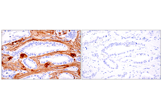Immunohistochemistry Image 7: COL1A1 (E3E1X) Mouse Monoclonal Antibody