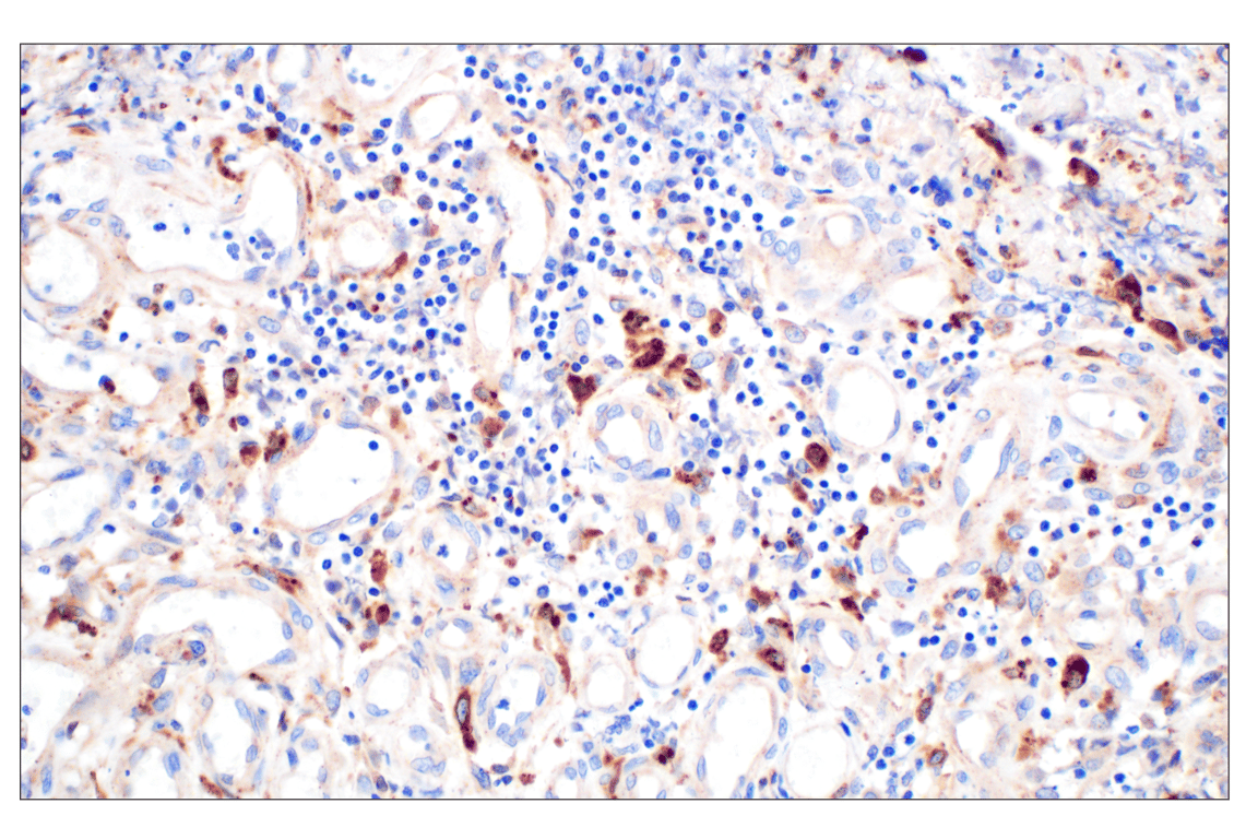 Cathepsin Z (F6D7U) Rabbit mAb | Cell Signaling Technology