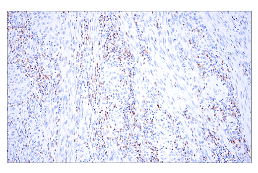 Immunohistochemistry Image 2: HPK1 (E1C3L) Rabbit Monoclonal Antibody (BSA and Azide Free)