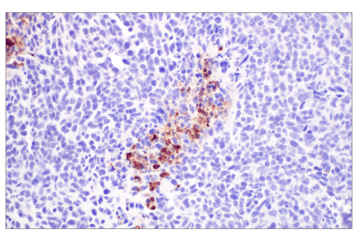 Immunohistochemistry Image 7: Citrullinated Histone H3 (Arg2) (F3C9B) Rabbit Monoclonal Antibody (BSA and Azide Free)
