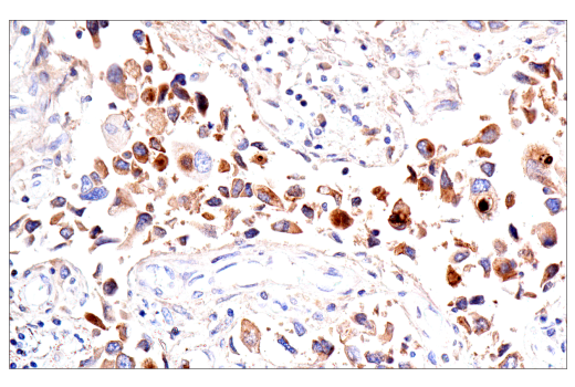Immunohistochemistry Image 3: IGFBP3 (E6C2E) Rabbit Monoclonal Antibody