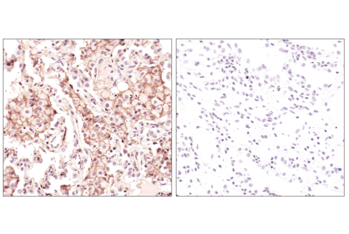 Immunohistochemistry Image 4: beta-Actin (13E5) Rabbit Monoclonal Antibody