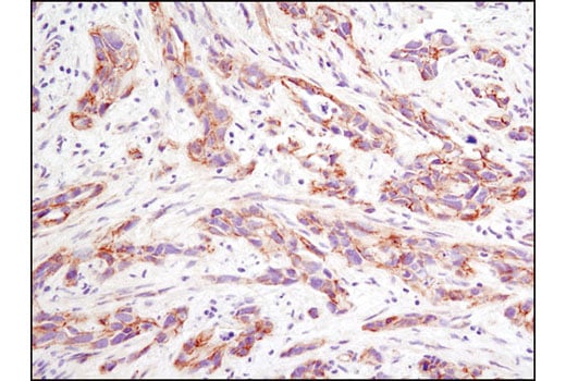 Immunohistochemistry Image 1: Non-phospho (Active) beta-Catenin (Ser33/37/Thr41) (D13A1) Rabbit Monoclonal Antibody