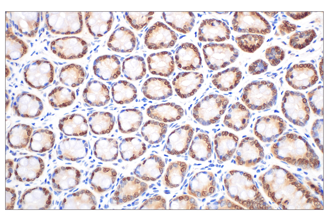 Immunohistochemistry Image 13: MTAP (E5R1I) Rabbit Monoclonal Antibody (BSA and Azide Free)