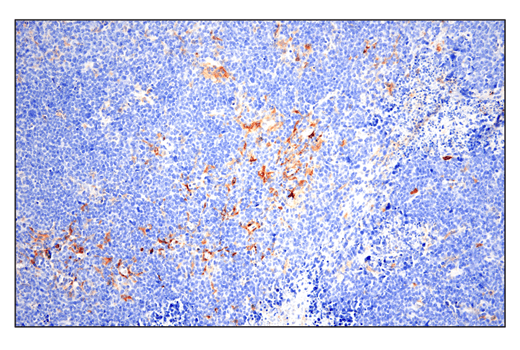 Immunohistochemistry Image 3: Phospho-SLP-76 (Ser376) (E3G9U) Rabbit Monoclonal Antibody (BSA and Azide Free)
