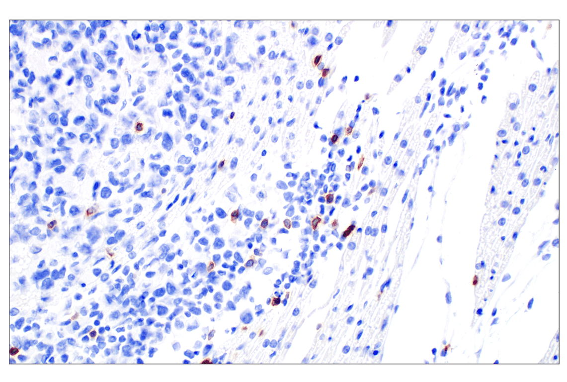 Immunohistochemistry Image 3: NCR1/NKp46 (F8M2L) Rabbit Monoclonal Antibody (IHC Formulated)