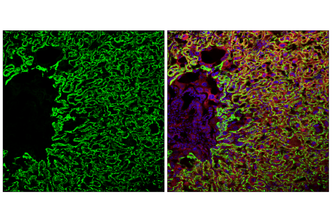 Immunofluorescence Image 1: Angiomotin (F7W8U) Rabbit Monoclonal Antibody