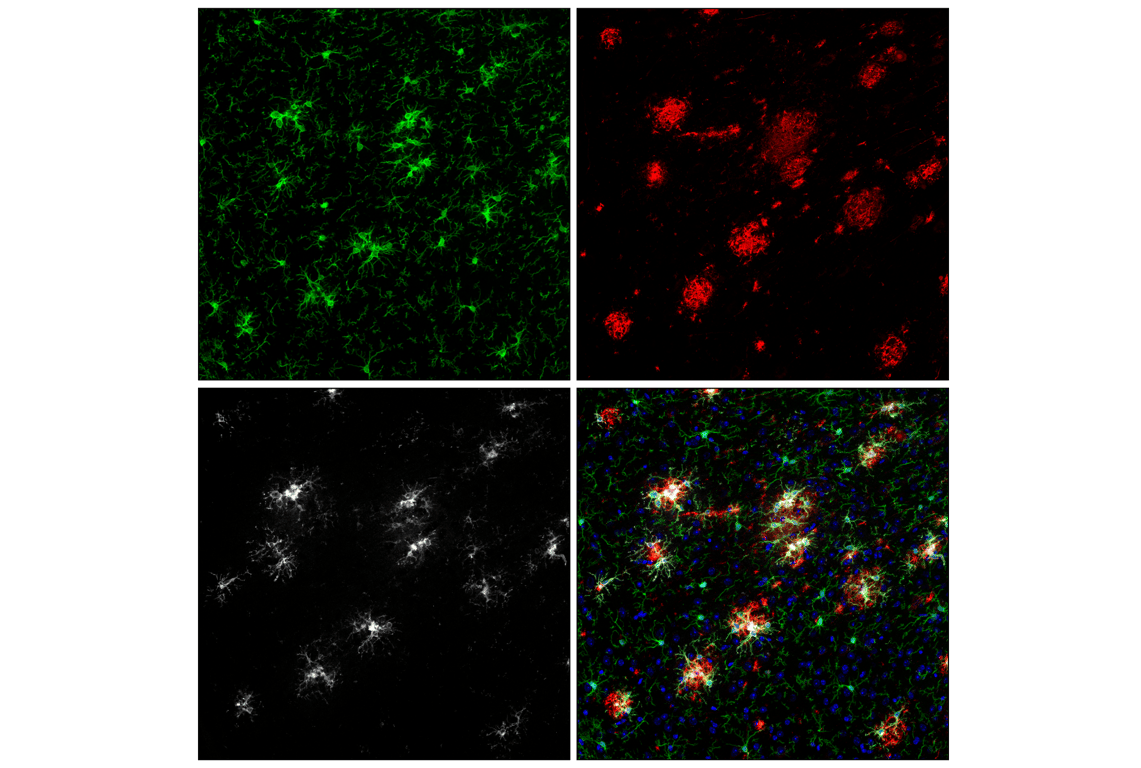 Immunofluorescence Image 2: Dectin-1/Clec7a (E3P5W) Horse Chimeric Monoclonal Antibody