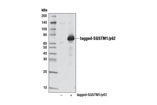 undefined Image 28: Mitophagy Antibody Sampler Kit
