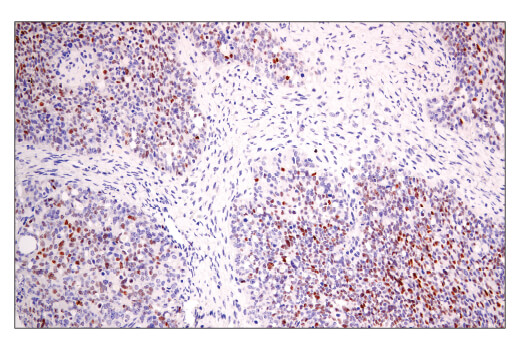 Immunohistochemistry Image 5: BCL6 (E5I8I) Rabbit Monoclonal Antibody (BSA and Azide Free)