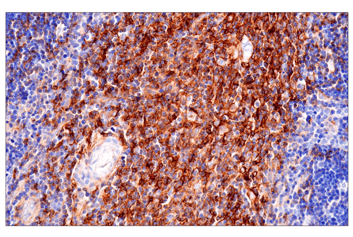 Immunohistochemistry Image 7: HLA-B (BC43) Mouse Monoclonal Antibody