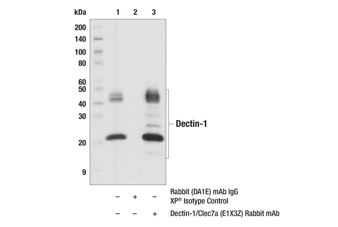 Immunoprecipitation Image 1: Dectin-1/Clec7a (E1X3Z) Rabbit Monoclonal Antibody
