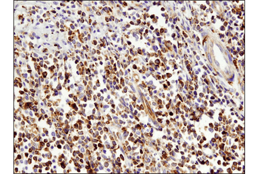 Immunohistochemistry Image 2: VISTA (D1L2G) Rabbit Monoclonal Antibody (BSA and Azide Free)