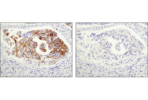 Immunohistochemistry Image 2: Keratin 20 (D9Z1Z) Rabbit Monoclonal Antibody (BSA and Azide Free)