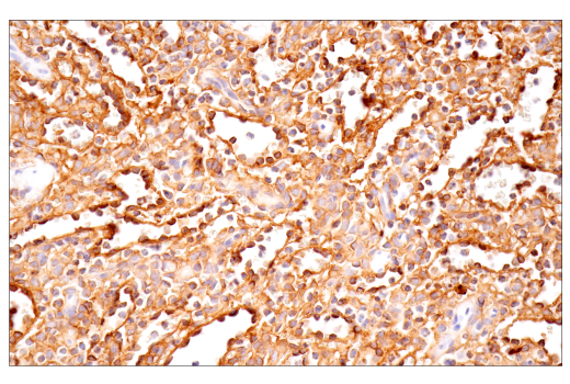 Immunohistochemistry Image 6: CD54/ICAM-1 (E3Q9N) Rabbit Monoclonal Antibody
