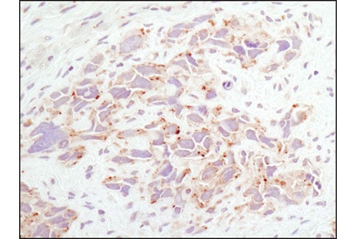 Immunohistochemistry Image 1: LAMTOR1/C11orf59 (D11H6) Rabbit Monoclonal Antibody (BSA and Azide Free)
