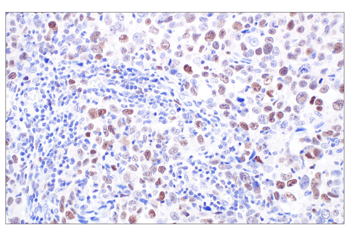 Immunohistochemistry Image 2: MASTL (F7I2C) Rabbit Monoclonal Antibody