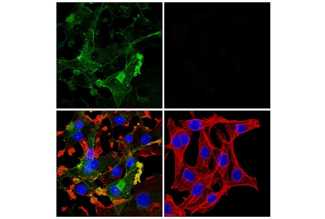 Immunofluorescence Image 1: Neuropilin-2 (E5Q2G) Rabbit Monoclonal Antibody