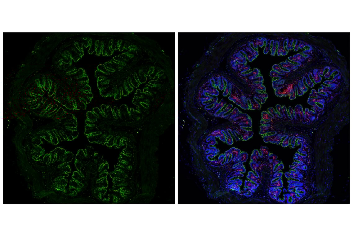 undefined Image 28: Genetics of Parkinson's Disease: Lysosomal Dysfunction Antibody Sampler Kit