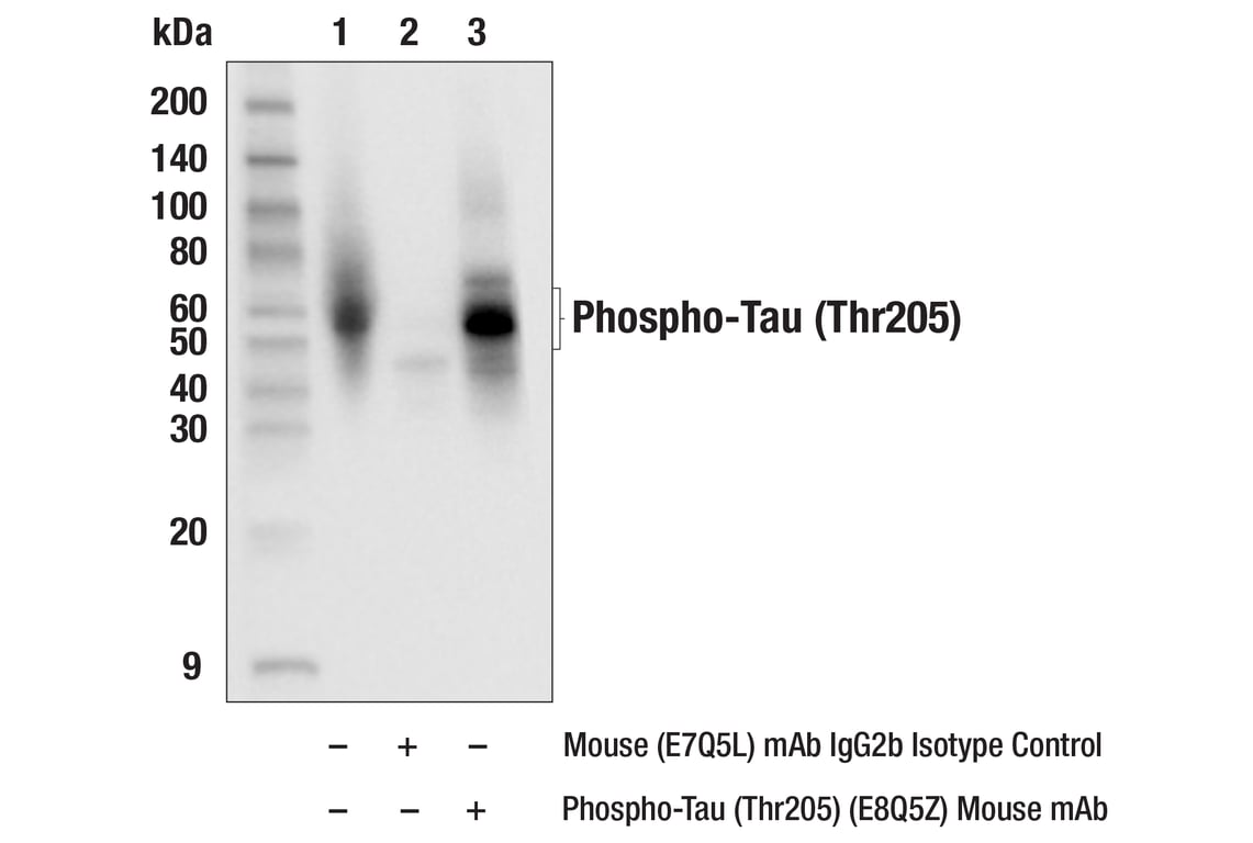 Immunoprecipitation Image 1: Phospho-Tau (Thr205) (E8Q5Z) Mouse Monoclonal Antibody