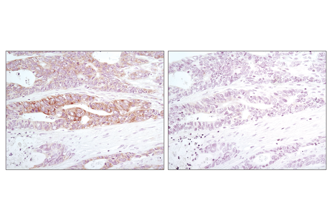 Immunohistochemistry Image 1: Phospho-eIF2 alpha (Ser51) (D9G8) Rabbit Monoclonal Antibody (BSA and Azide Free)