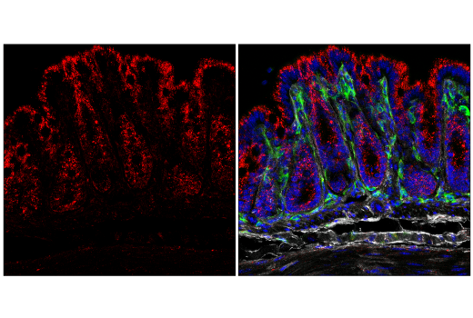 LAMP1 (E5N9Z) Rabbit mAb | Cell Signaling Technology